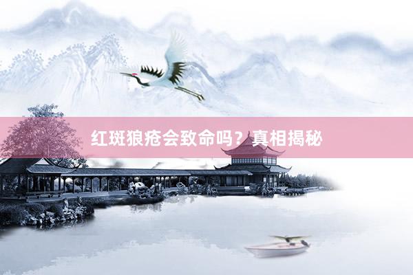 红斑狼疮会致命吗？真相揭秘